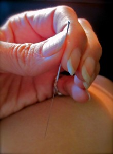 Acupuncture Needle / ©Image Elemental Changes/Wendy Brown, Lic.Ac.